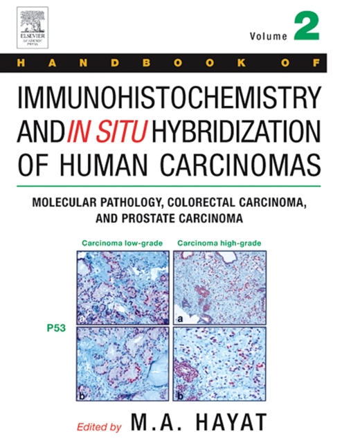 Handbook of Immunohistochemistry and in Situ Hybridization of Human Carcinomas