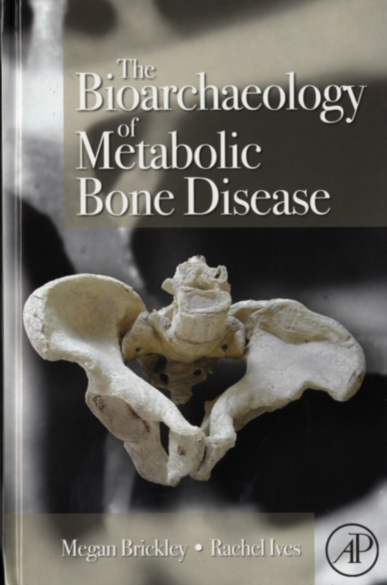 Bioarchaeology of Metabolic Bone Disease