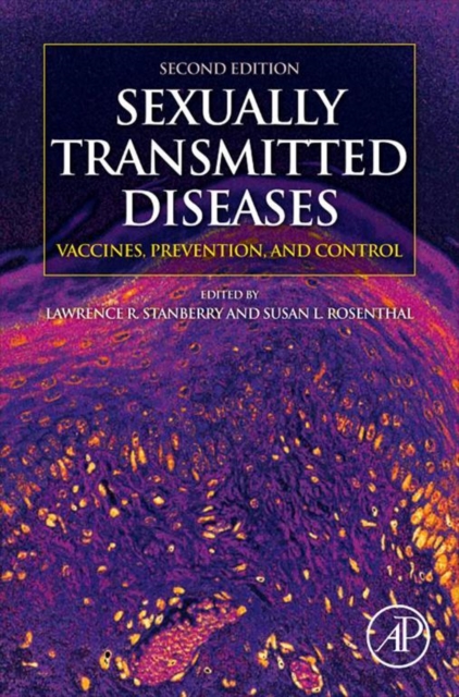 Sexually Transmitted Diseases
