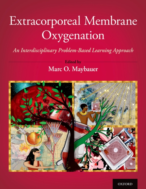 Extracorporeal Membrane Oxygenation