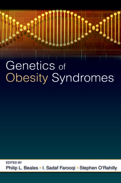 Genetics of Obesity Syndromes