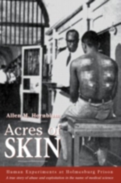 Acres of Skin