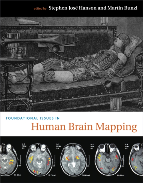 Foundational Issues in Human Brain Mapping