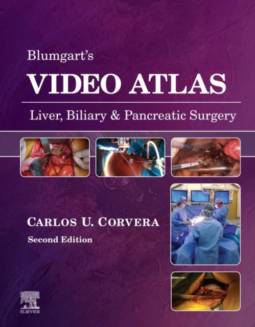 Blumgart's Video Atlas: Liver, Biliary & Pancreatic Surgery