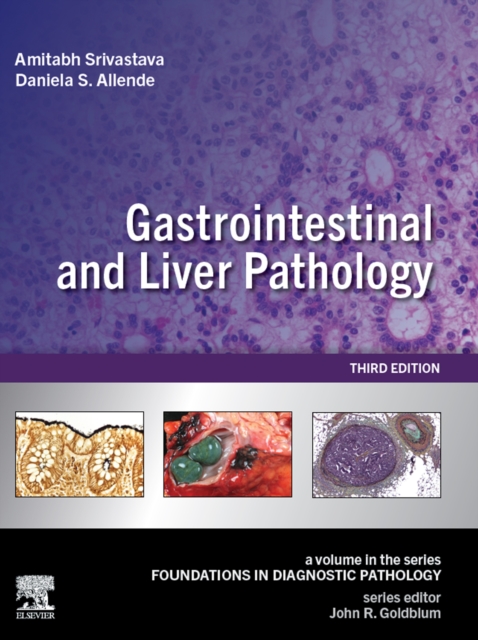 Gastrointestinal and Liver Pathology E-Book
