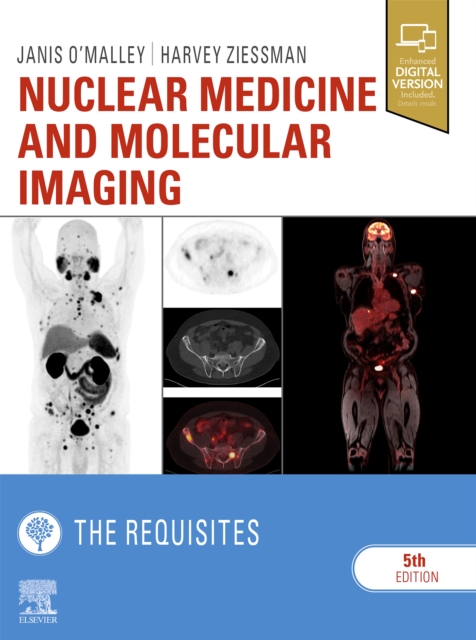 Nuclear Medicine and Molecular Imaging: The Requisites E-Book