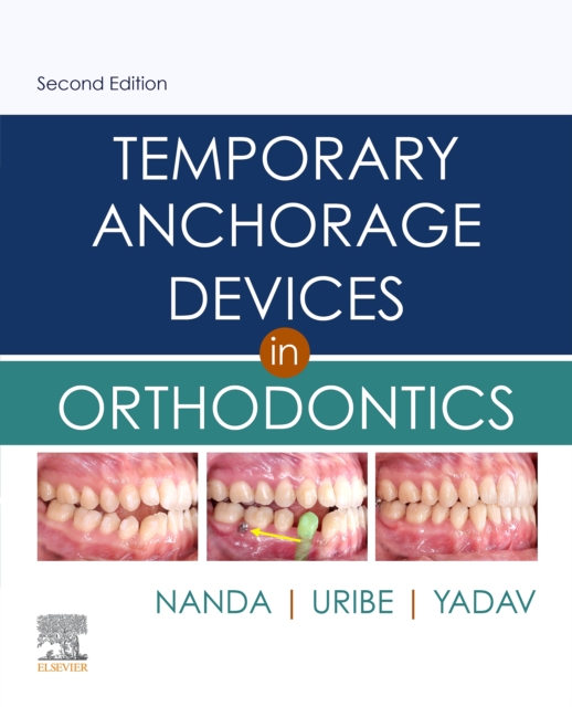 Temporary Anchorage Devices in Orthodontics E-Book
