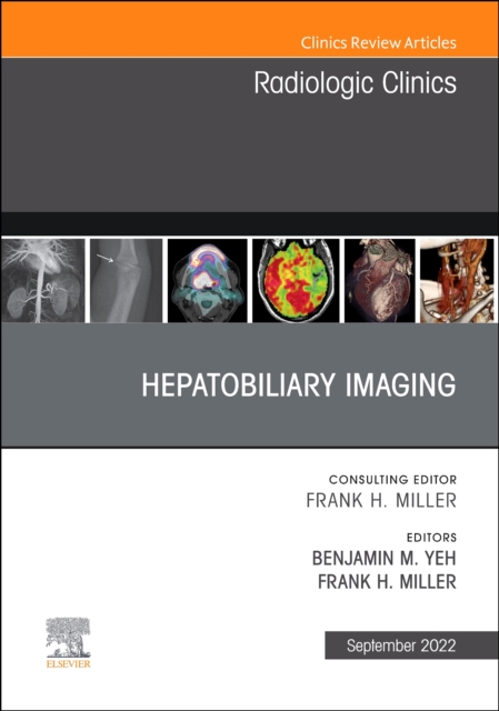 Hepatobiliary Imaging, An Issue of Radiologic Clinics of North America, E-Book