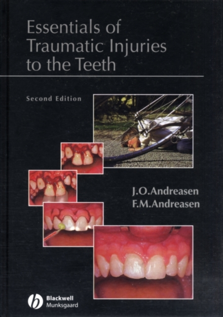 Essentials of Traumatic Injuries to the Teeth
