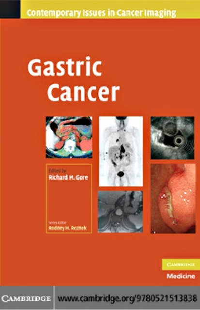 Gastric Cancer