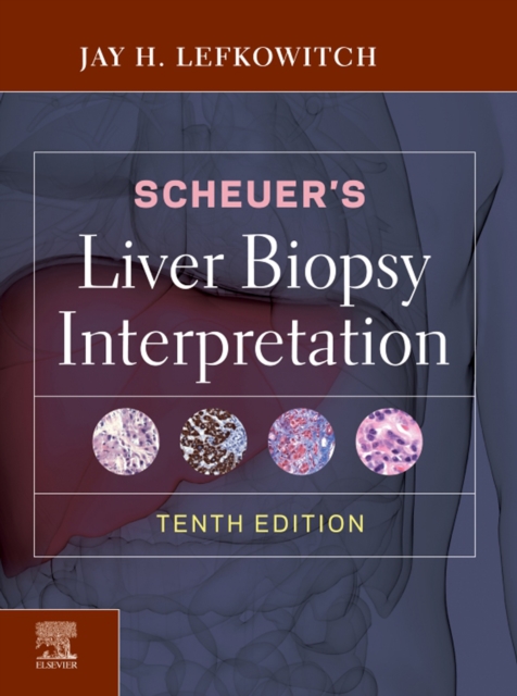 Scheuer's Liver Biopsy Interpretation