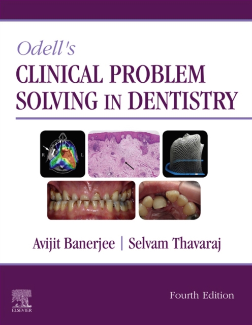 Odell's Clinical Problem Solving in Dentistry E-Book