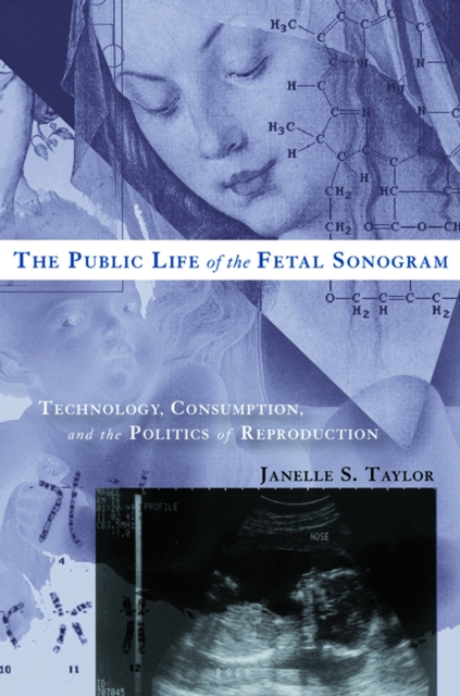 Public Life of the Fetal Sonogram