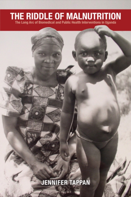 Riddle of Malnutrition