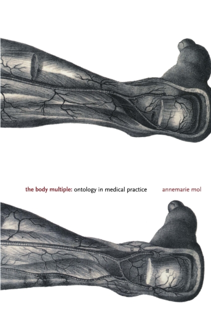 Body Multiple