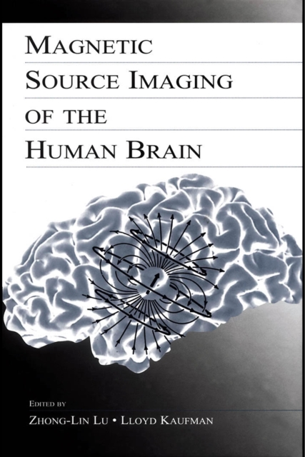 Magnetic Source Imaging of the Human Brain