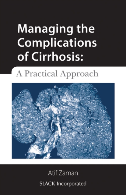Managing the Complications of Cirrhosis